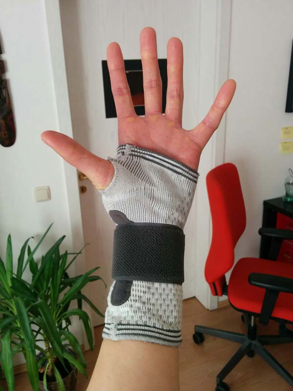 Doctor's advice: limit wrist movement to allow tendons to heal